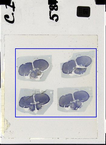 Media type: image; Special Collections 3298   shows specimen_part histological serial section;